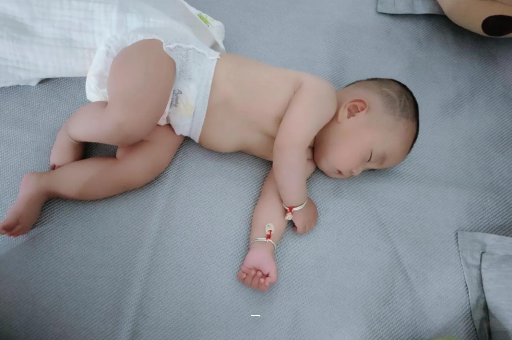 临邑宝宝脸上有白色斑块